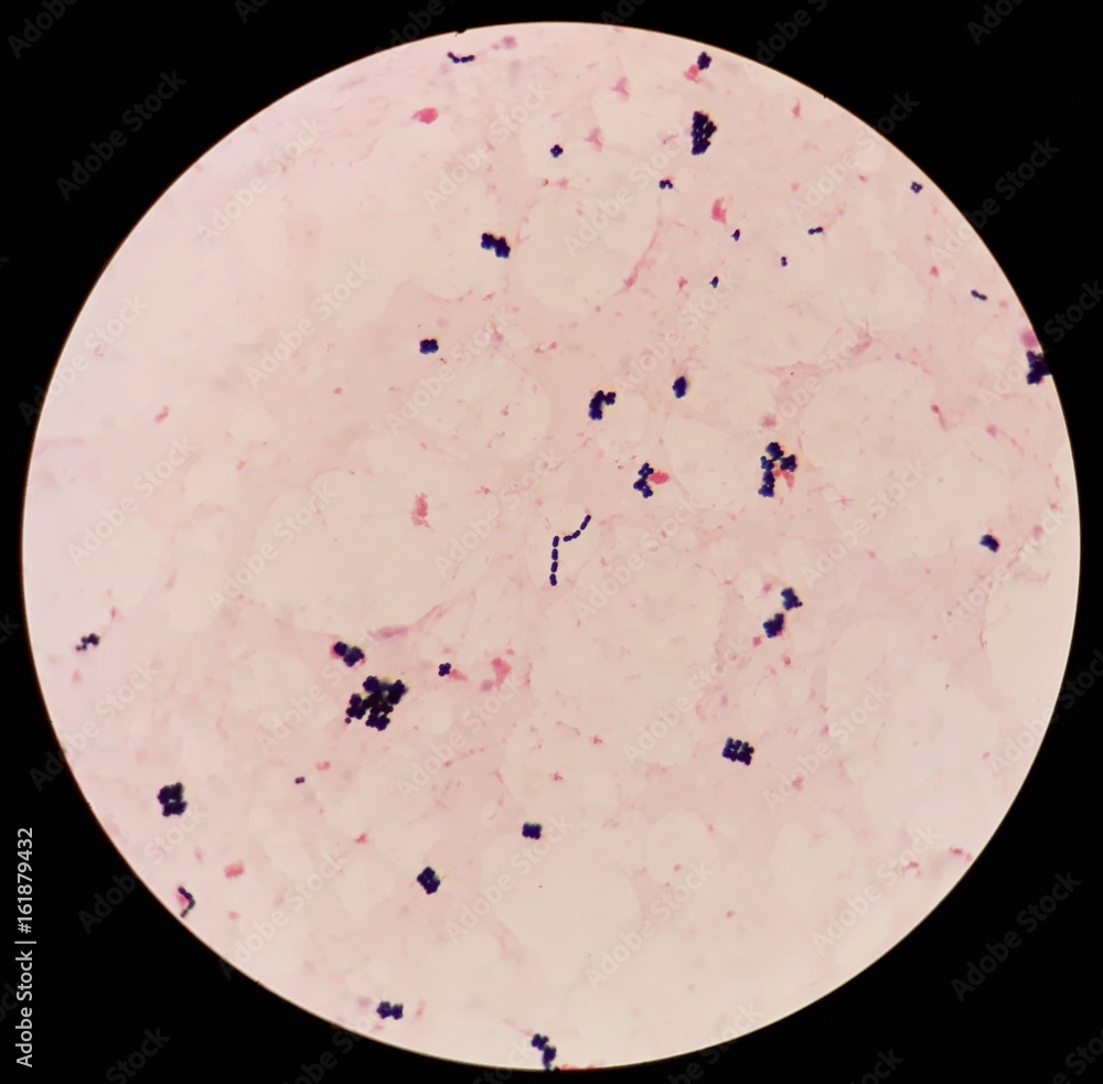 Foto Stock Smear of human blood cultured Gram's stained with gram