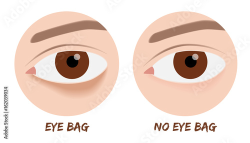 eye bag vector