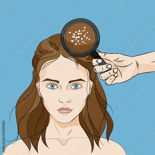 Woman with long brown messy hair with dandruff and a hand holding a magnifier on blue background