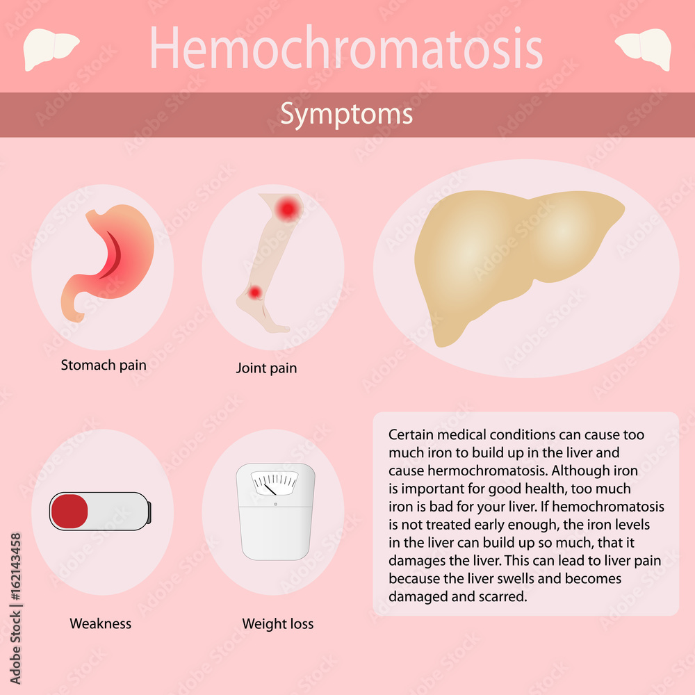 Symptoms of Hemochromatosis of the liver. Vector illustration Stock ...