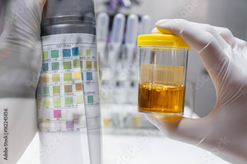 Urine sample