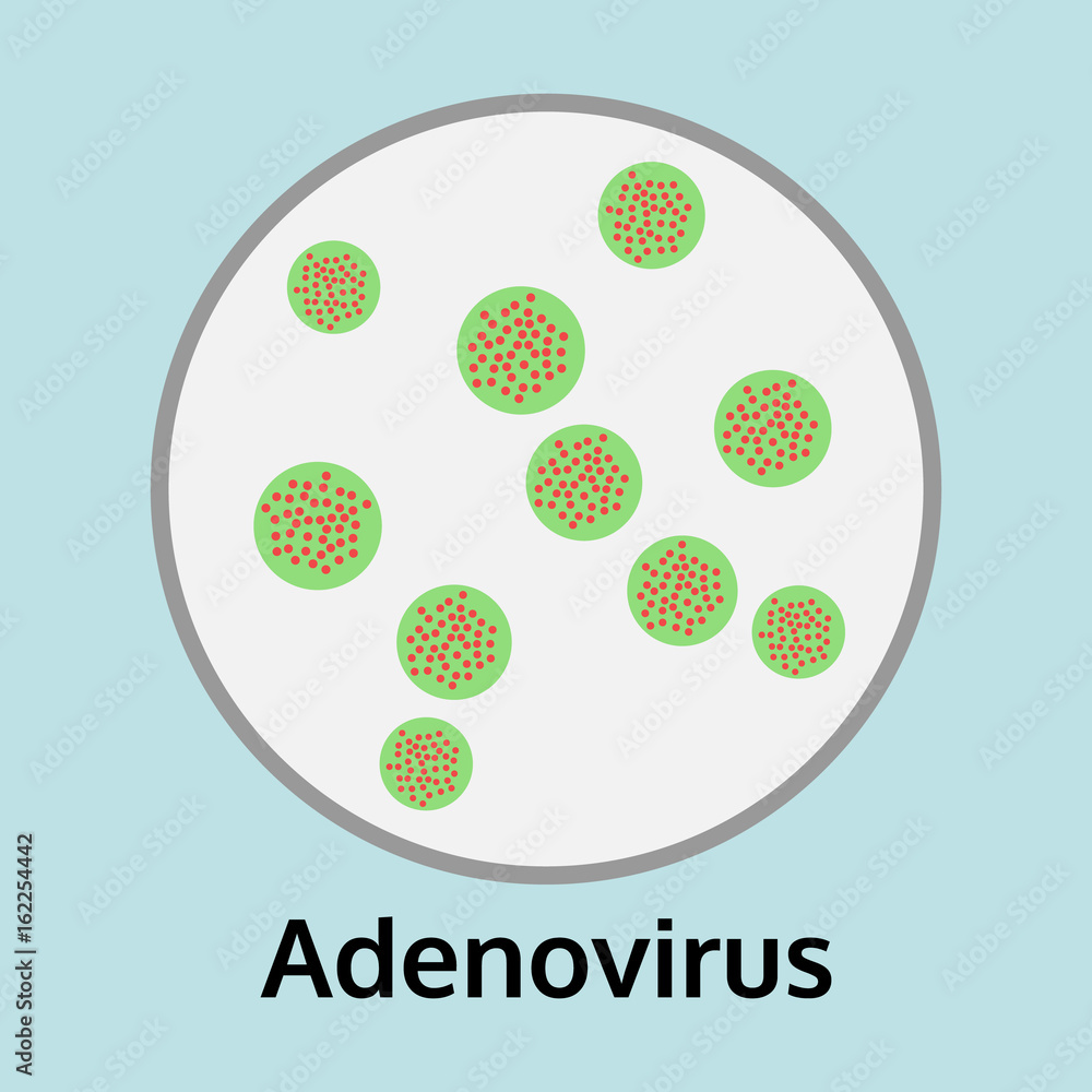 illustration of Adenovirus disease in the trial tray, medical info graphic virus vector