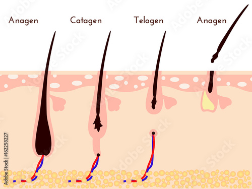 Hare care loos. life cycle of hair fall. vector illustration.