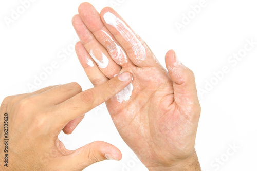 Man applying moisturizer cream on hands, dry skin