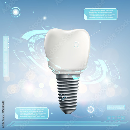 Human dental implant.