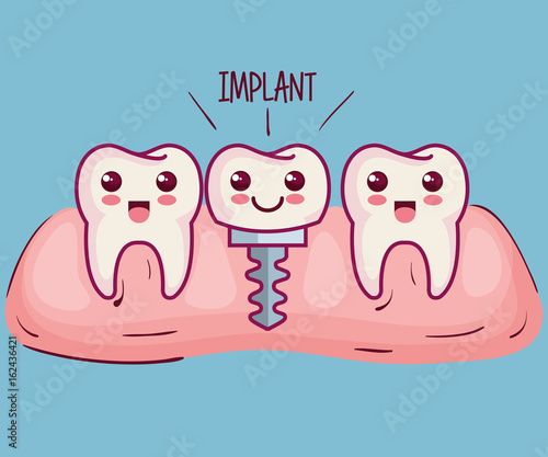 Kawaii teeth and implant over blue background vector illustration