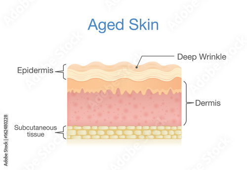 Aged skin layer in 3D vector style. Illustration about health care and beauty.
