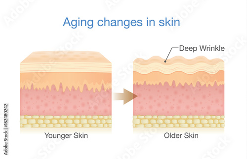 Aging Changes in Skin. Illustration about medical diagram and health care.