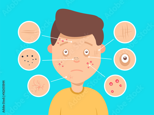 Male facial skin problems vector illustration. Acne and dark spots, wrinkles and circles under the eyes for cosmetics