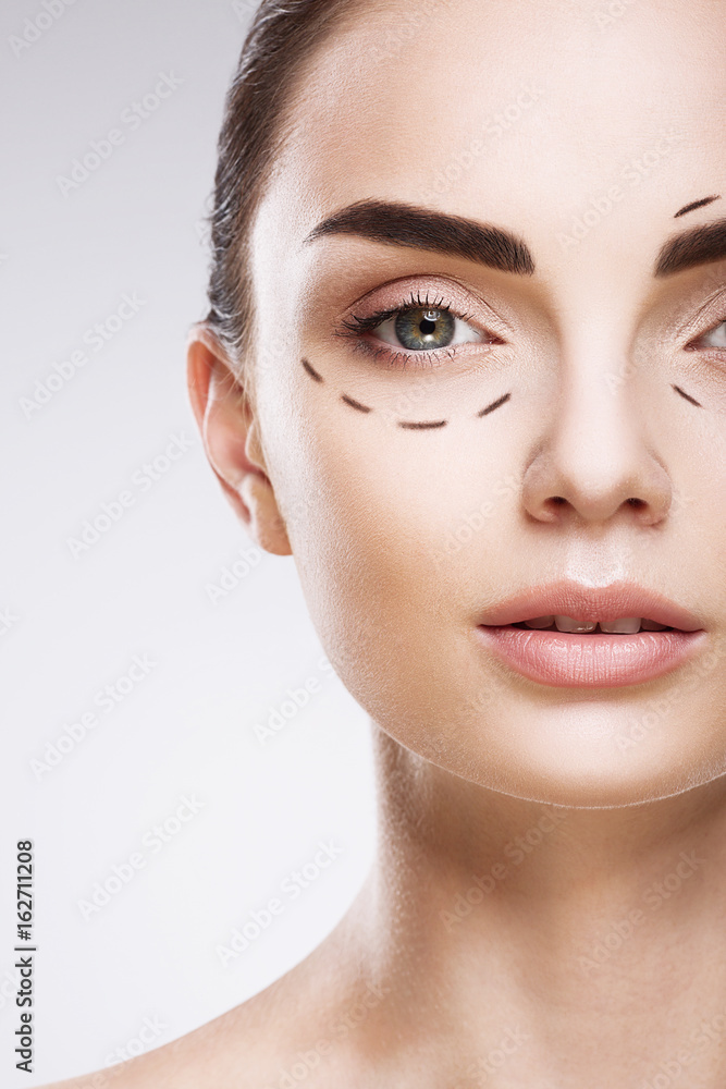 Perforation lines on patient's face Perforation lines on patient's face