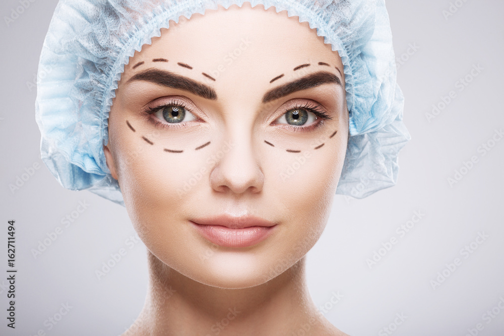 Perforation lines on patient's face Perforation lines on patient's face