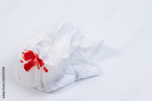 Wound blood, blood on tissue paper on white background. Nosebleed or epistaxis treatment blood in tissue paper. Health medical.