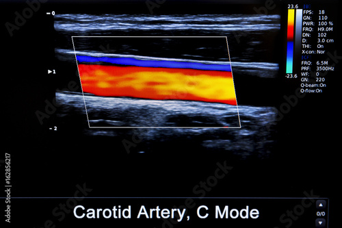 Colourful image of modern ultrasound monitor photo
