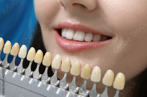 Dentist checking and selecting color of young woman teeth