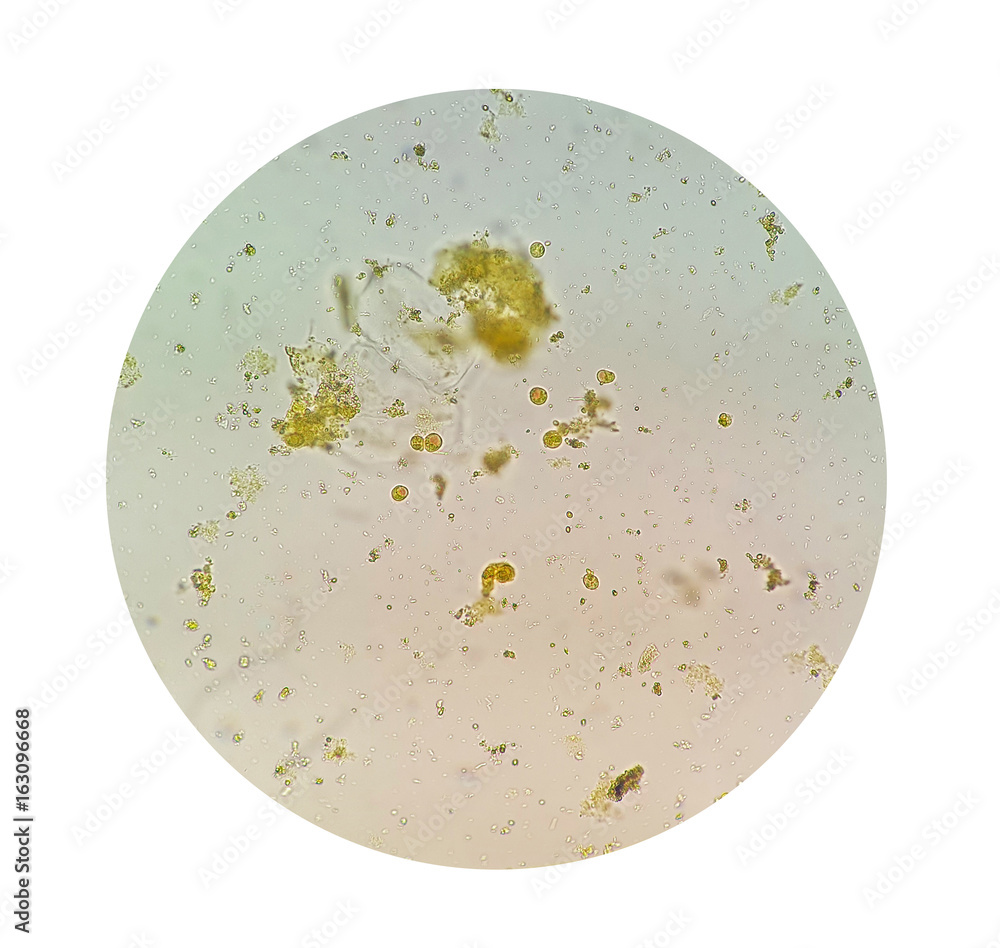 Stool parasites examination test for parasites or eggs in a human stool  sample with iodine stained under microscope. The parasites are associated  with intestinal infections. Stock Photo | Adobe Stock