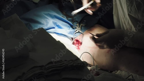 Operation. Heart surgery. Surgery.