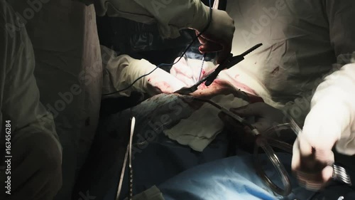 Operation. Heart surgery. Surgery.