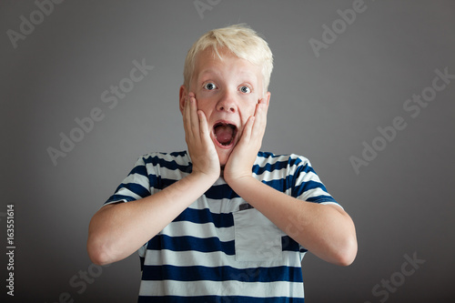 Quadro su tela Shocked teen in striped shirt with hands on cheeks