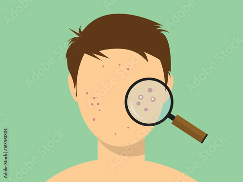 human male acne face with magnifying glass