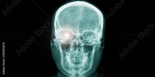 x ray of human head with shining eye