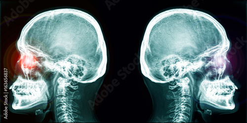 Bright eye of skull backing to each other