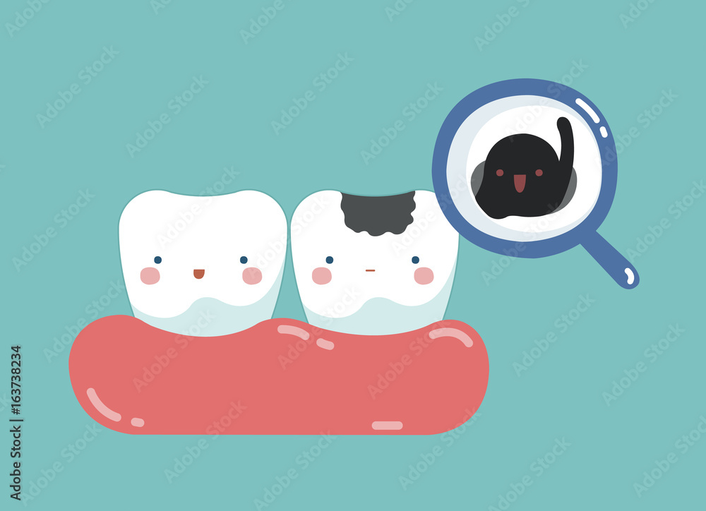 Fototapeta premium Decayed tooth and bacteria , tooth and teeth of dental concept
