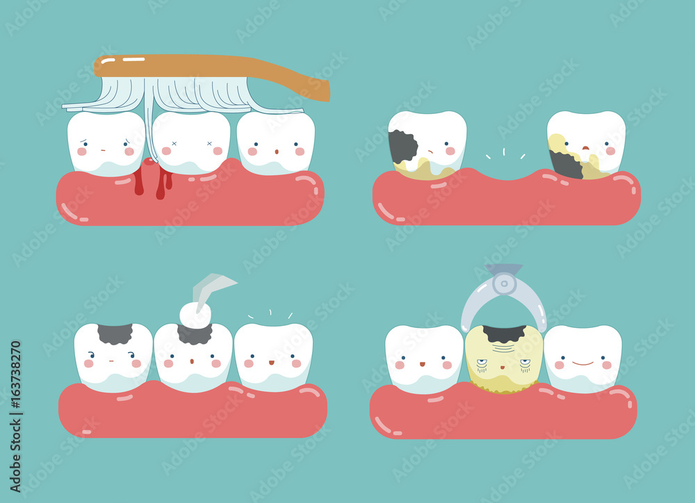 Obraz premium Brushing make hurt gum and teeth, decayed teeth ,filling tooth of dental set