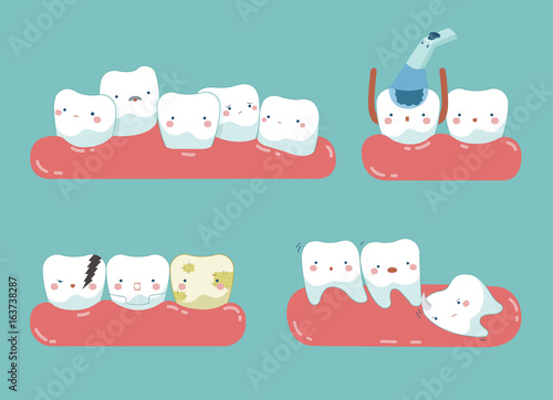 Check up decayed tooth , Wisdom tooth of dental set