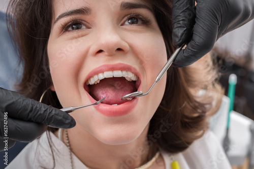 Close-up of female with open mouth during oral checkup at the dentist.Dentist