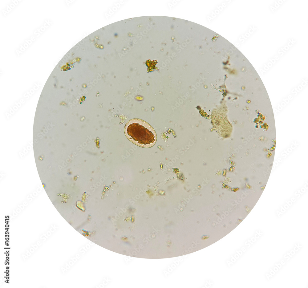 parasite in stool pictures human