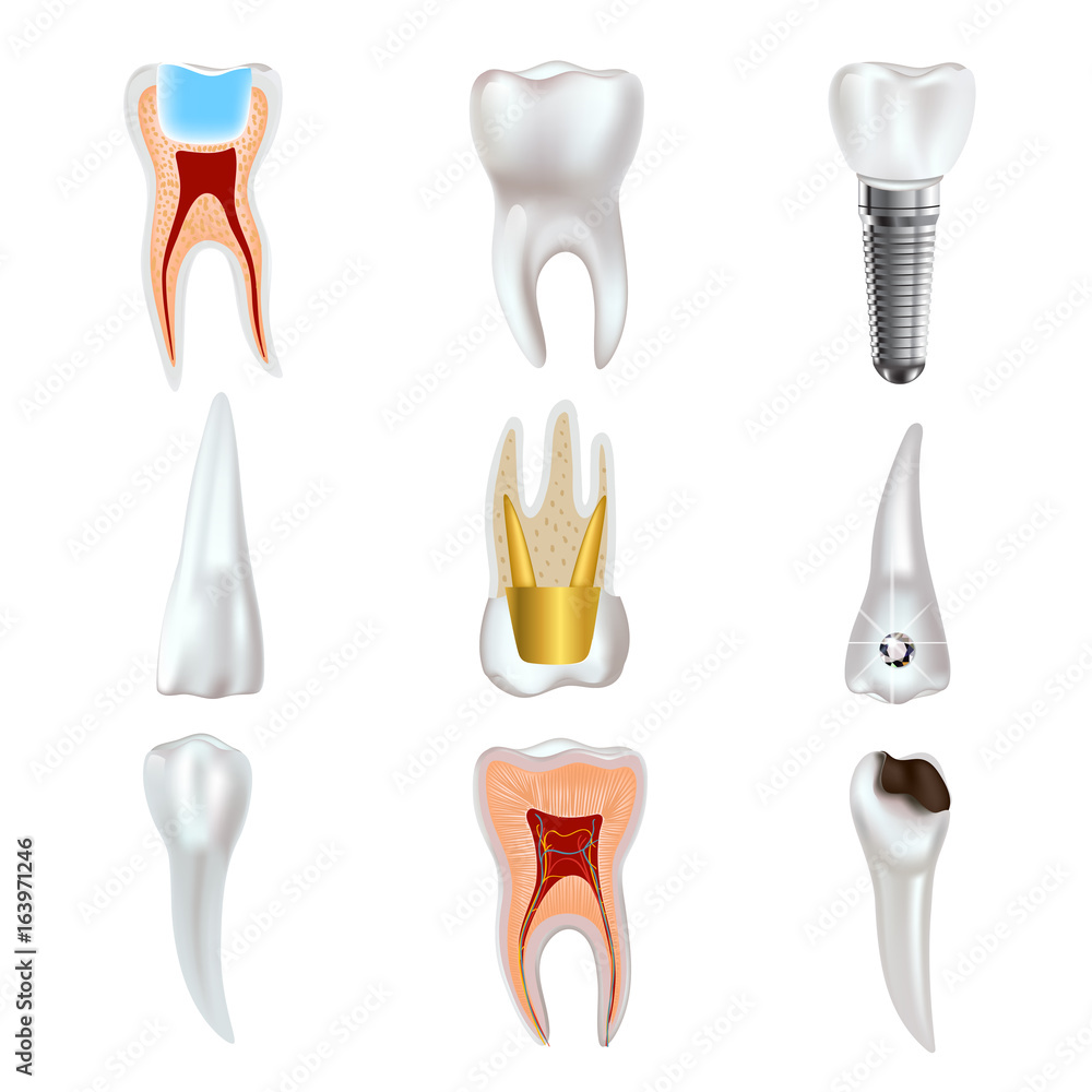 Dental implant and real tooth anatomy icon set. Dental implant and real tooth anatomy icon set.