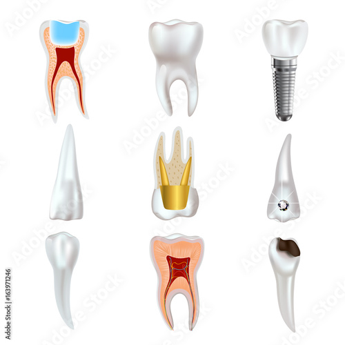 Dental implant and real tooth anatomy icon set.