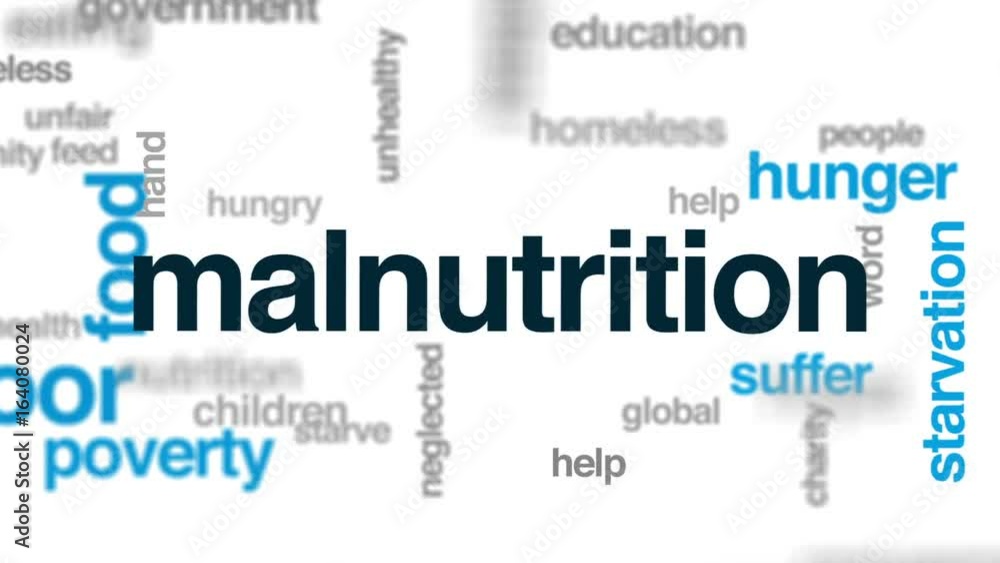 Malnutrition animated word cloud, text design animation. Malnutrition animated word cloud, text design animation.