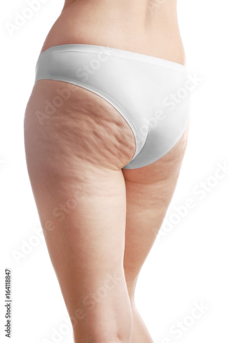 Woman with cellulite on buttocks and legs against white background