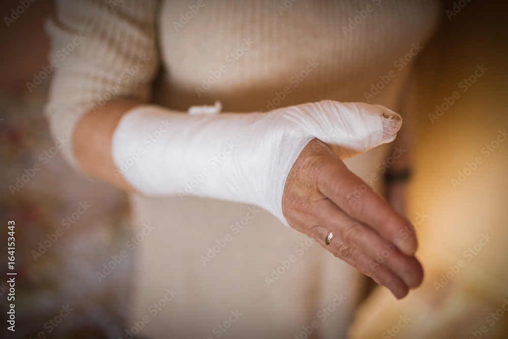 Obraz premium Woman with hand in gypsum. Selective focus.