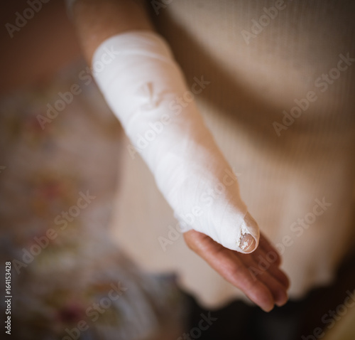 Woman with hand in gypsum. Selective focus.