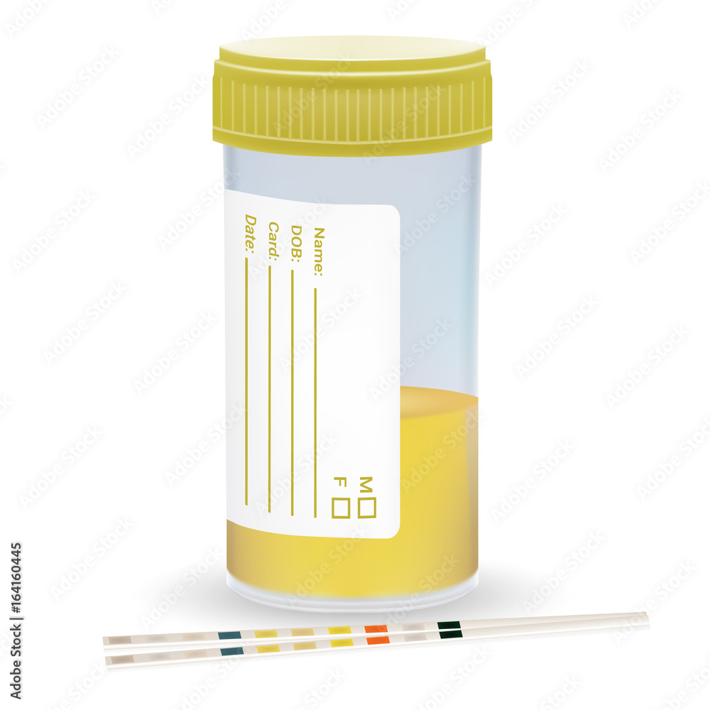 Сонник моча на полу. Сонник моча на полу. Сонник моча на полу. К чему снится моча. Исследование мочи помутнение.