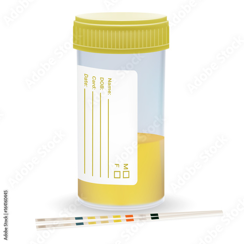 Urine Test Strip With The Plastic Jar Of Urine. Medical Examination Isolated On A White Background. Realistic Vector Illustration.