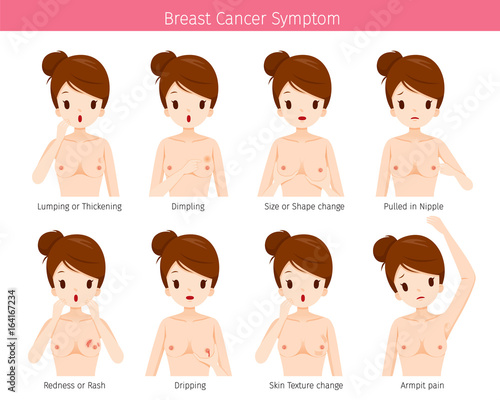 Naked Woman With Breast Cancer Symptoms, Mammary, Boob, Body, Organs, Physical, Sickness, Health