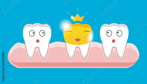 Tooth with golden dental crown icon in cartoon style on a white background