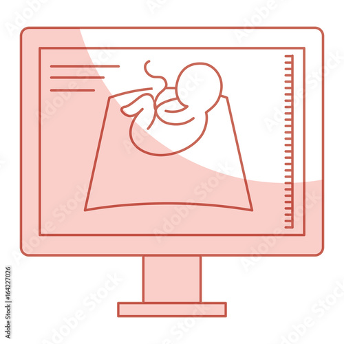 Ultrasound monitor isolated icon vector illustration design