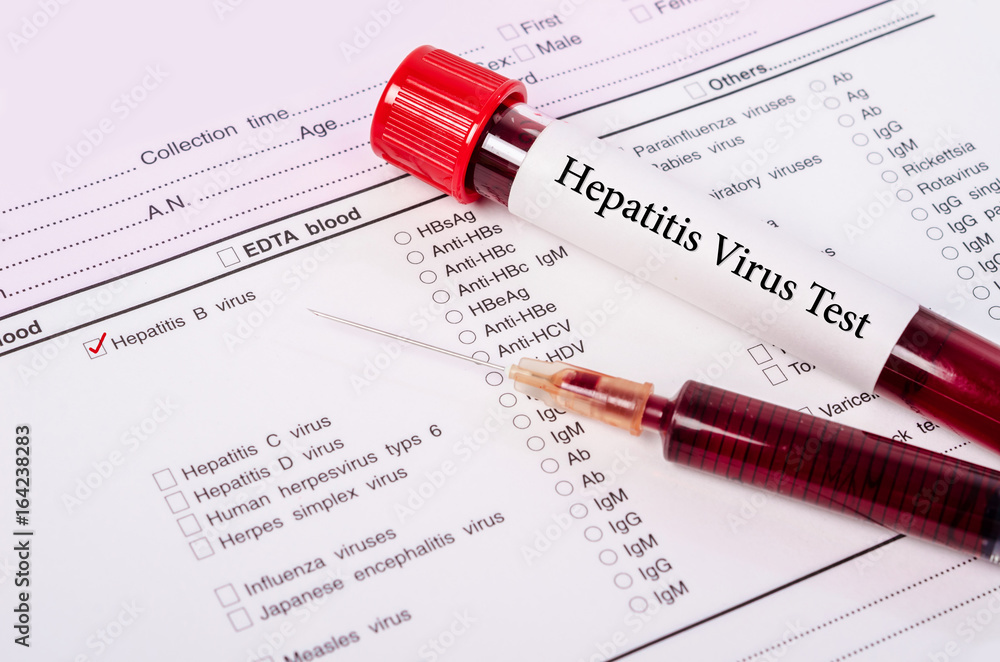 World hepatitis day concept. World hepatitis day concept.