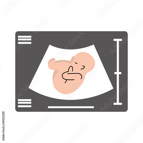 Ultrasound monitor isolated icon vector illustration design