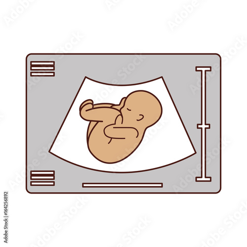 Ultrasound monitor isolated icon vector illustration design