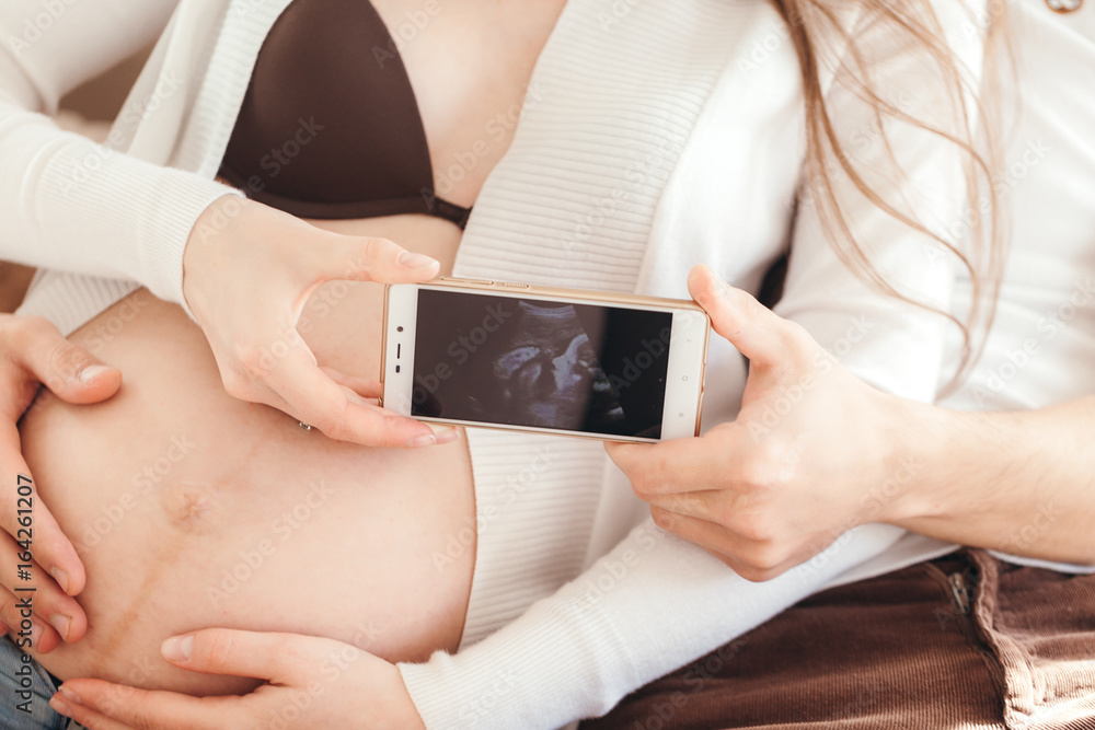 Young couple in love showing an ultrasound picture of their baby Young couple in love showing an ultrasound picture of their baby