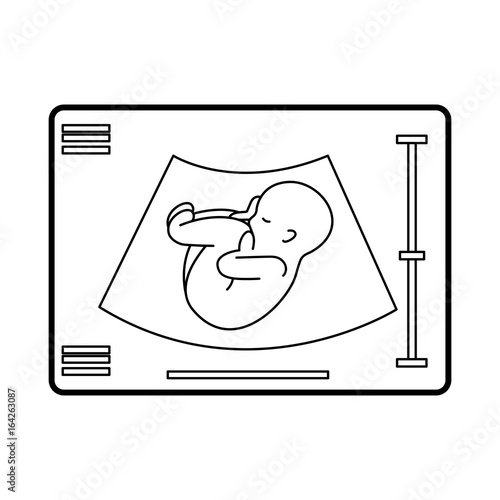 Ultrasound monitor isolated icon vector illustration design