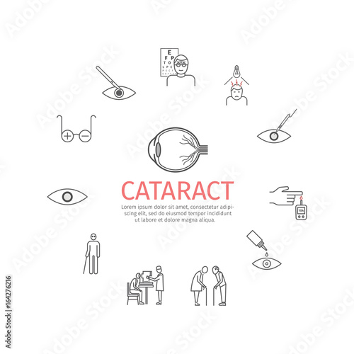 Cataract. Symptoms, Treatment. Line icons set. Vector signs