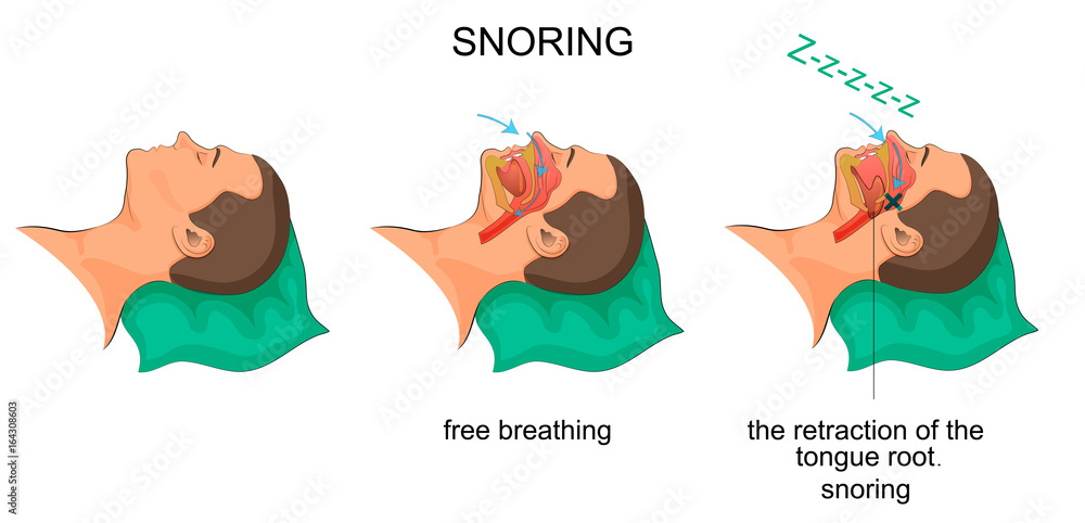 sleeping man snores