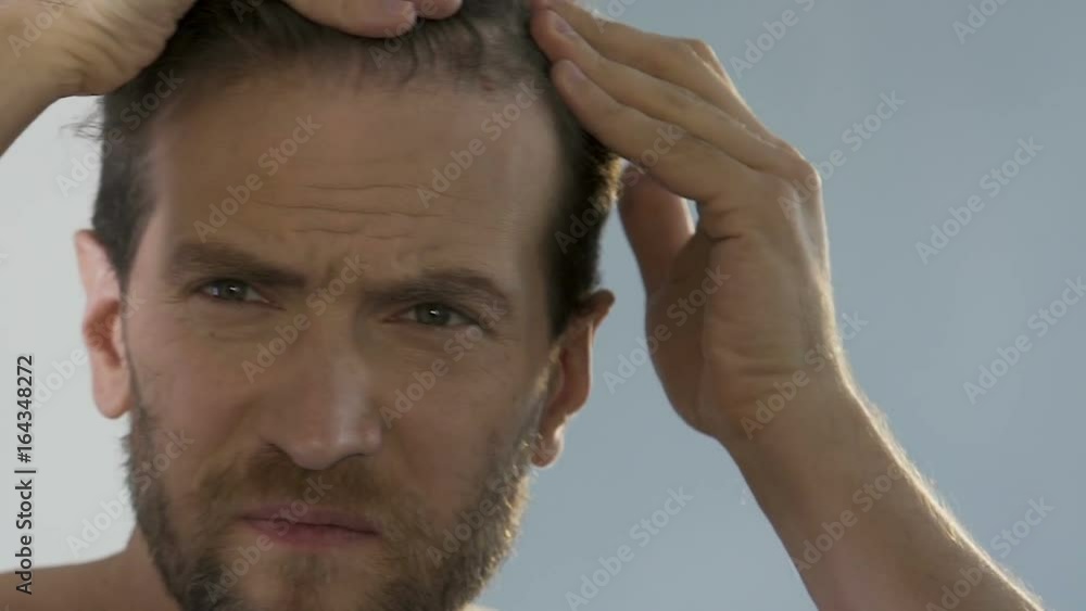 Bearded man standing in front of mirror and looking at his thinning hair, bald Bearded man standing in front of mirror and looking at his thinning hair, bald