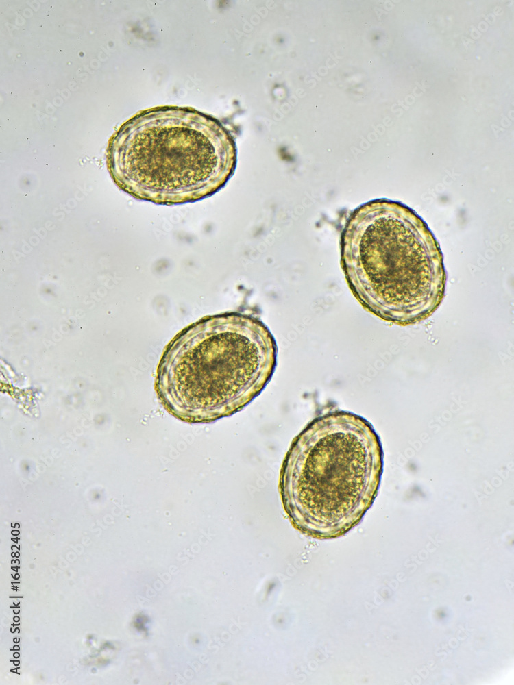 Egg Of Ascaris Lumbricoides In Stool Analyze By Microscope Foto De | My ...